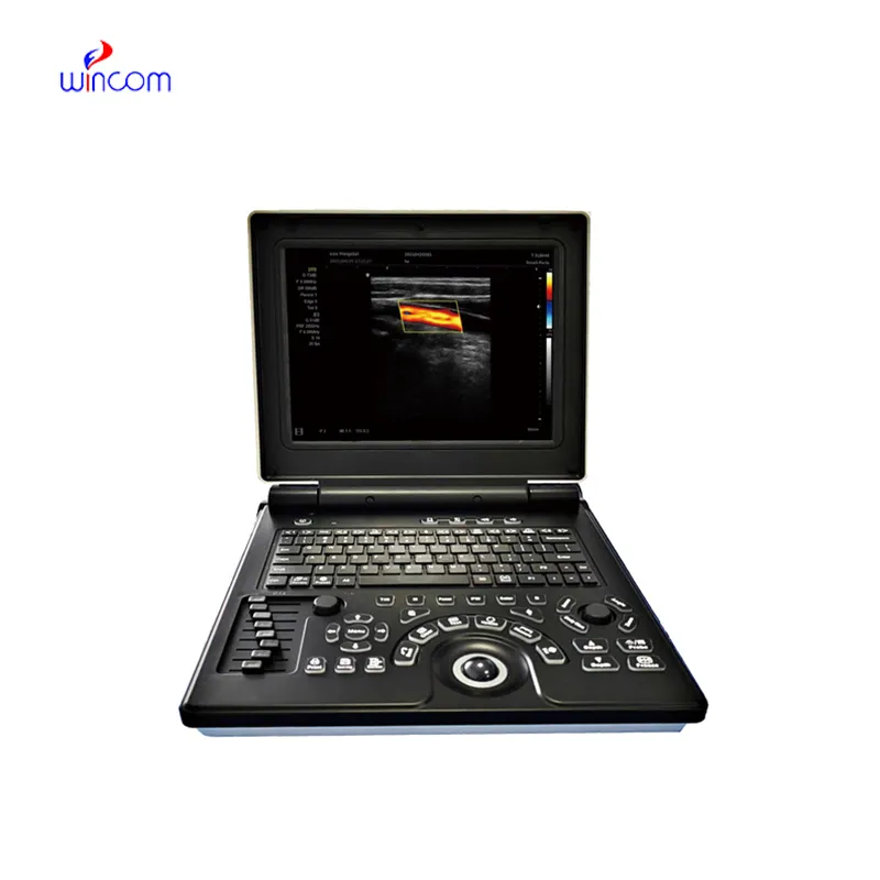 Ultrasoon diagnostisch systeem voor laptopkleurendoppler USS-N20C